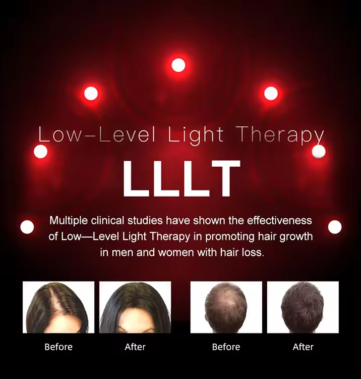 Wholesale Hair Growth Helmet Laser Cap Red Light Therapy Anti Hair Loss